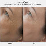 DermaSEMITA+ pokročilé svetelné beauty ošetrenie pre rozjasnenú a sviežu pleť