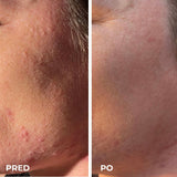 DermaSEMITA+ pokročilá LED svetelná terapia pre zdravú a žiarivú pleť