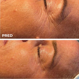 DermaSEMITA+ pokročilá LED svetelná terapia pre zdravú a žiarivú pleť