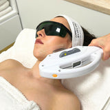 IPL Fotoomladenie – fotorejuvenizácia: Mladšia a zdravšia pleť pre ženy aj mužov