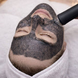 OxyGeneo + Rádiofrekvencia – Intenzívna revitalizácia a omladenie pleti