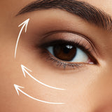 Thermolifting – Lifting bez skalpela