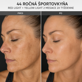 DermaSEMITA+ pokročilé svetelné beauty ošetrenie pre rozjasnenú a sviežu pleť